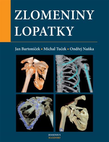 Obrázok Zlomeniny lopatky