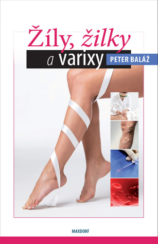 Obrázok Žíly, žilky a varixy