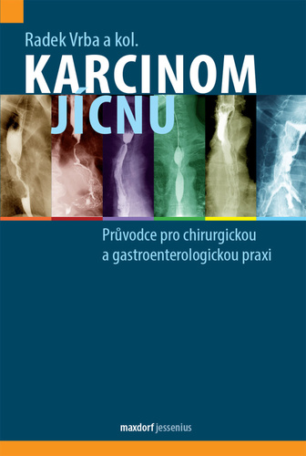 Obrázok Karcinom jícnu - Průvodce pro chirurgickou a gastroenterologickou praxi