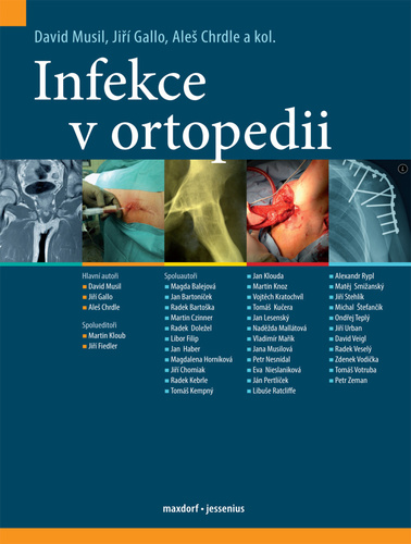 Obrázok Infekce v ortopedii