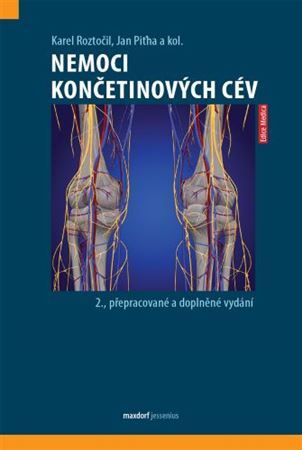 Obrázok Nemoci končetinových cév