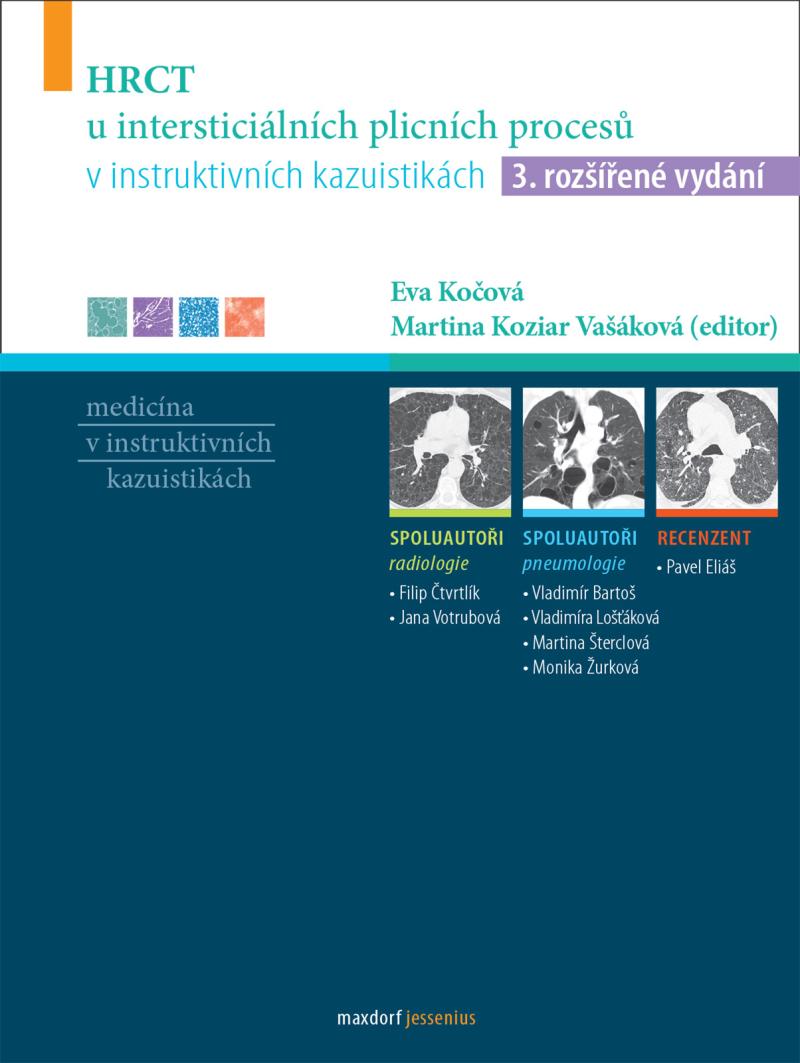 Obrázok HRCT u intersticiálních plicních procesů v instruktivních kazuistikách
