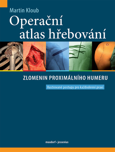 Obrázok Operační atlas hřebování zlomenin proximálního humeru