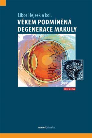Obrázok Věkem podmíněná degenerace makuly
