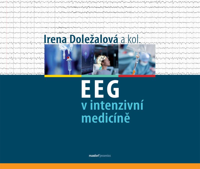 Obrázok EEG v intenzivní medicíně