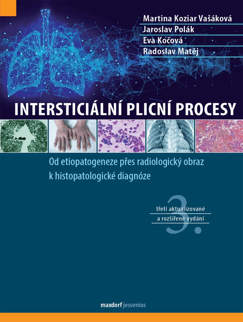 Obrázok Intersticiální plicní procesy