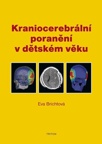 Obrázok Kraniocerebrální poranění v dětském věku