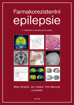Obrázok Farmakorezistentni epilepsie - 2. vydání