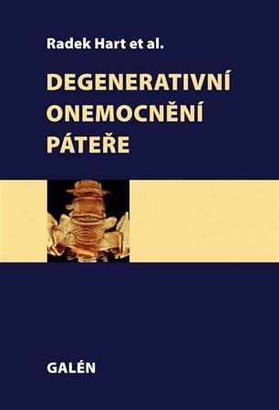 Obrázok Degenerativní onemocnění páteře