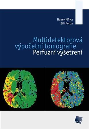 Obrázok Multidetektorová výpočetní tomografie - Perfuzní vyšetření