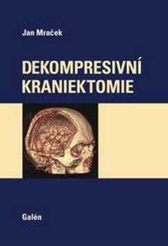 Obrázok Dekompresivní kraniektomie