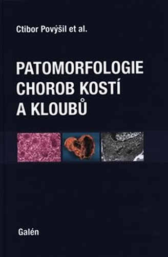 Obrázok Patomorfologie chorob kostí a kloubů