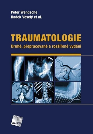 Obrázok Traumatologie