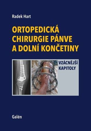 Obrázok Ortopedická chirurgie pánve a dolní končetiny - Vzácnější kapitoly
