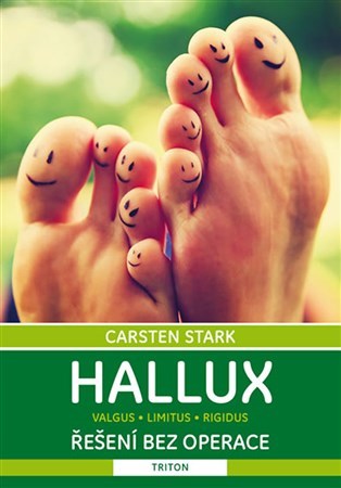 Obrázok Hallux - Řešení bez operace