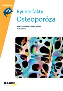 Obrázok Rýchle fakty: Osteoporóza