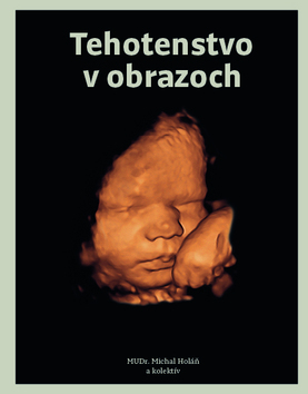 Obrázok Tehotenstvo v obrazoch
