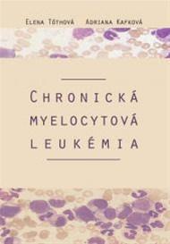 Obrázok Chronická myelocytová leukémia