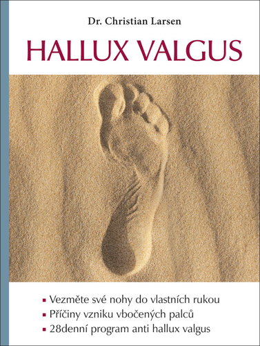 Obrázok Hallux valgus