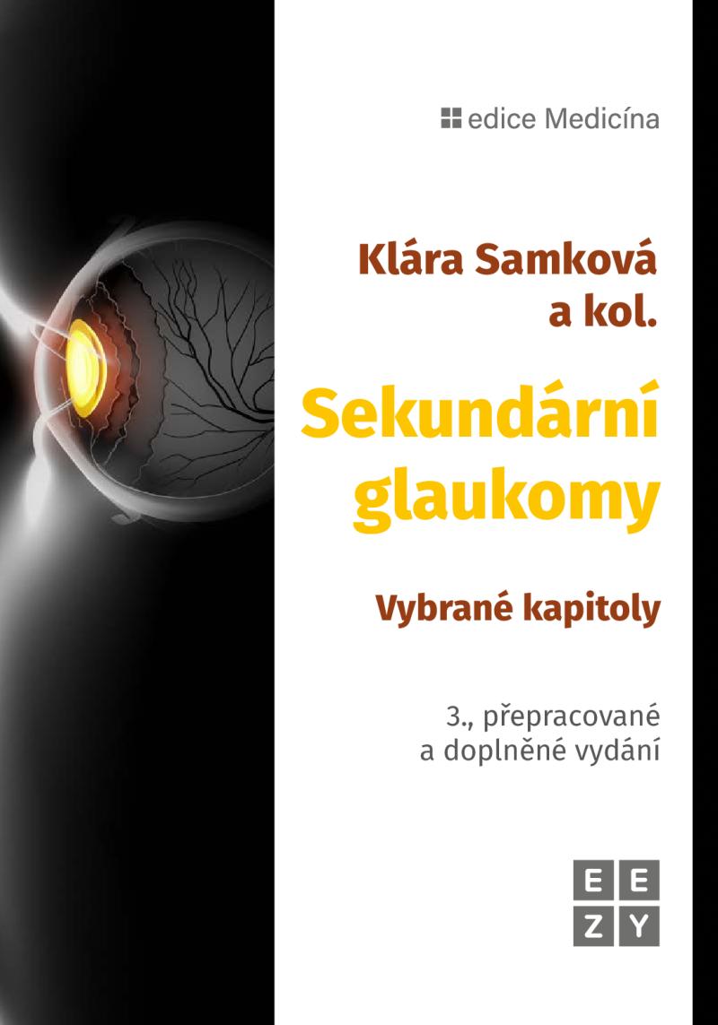 Obrázok Sekundární glaukomy - Vybrané kapitoly