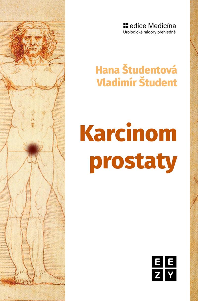 Obrázok Karcinom prostaty