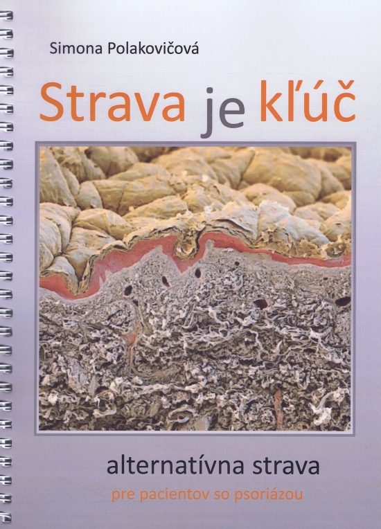 Obrázok Strava je kľúč